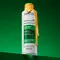 Dandruff or Dry Scalp? How to Tell the Difference