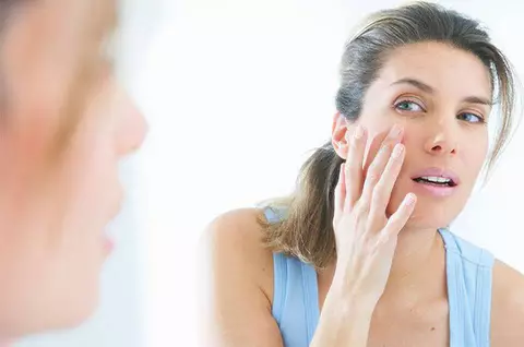 Adult Acne vs. Younger Acne