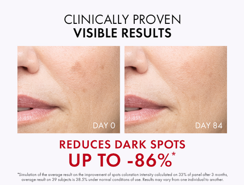 Liftactiv Specialist B3 Dark Spots Serum