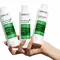 Everything About Dandruff and How to Deal with It