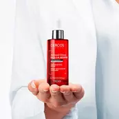 SCALP TREATMENTS