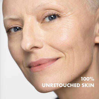 Clinically measured by dermatologists