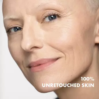 Clinically measured by dermatologists