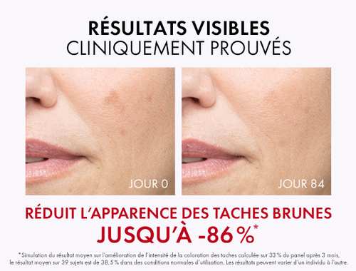 Liftactiv Specialist B3 Dark Spots Serum
