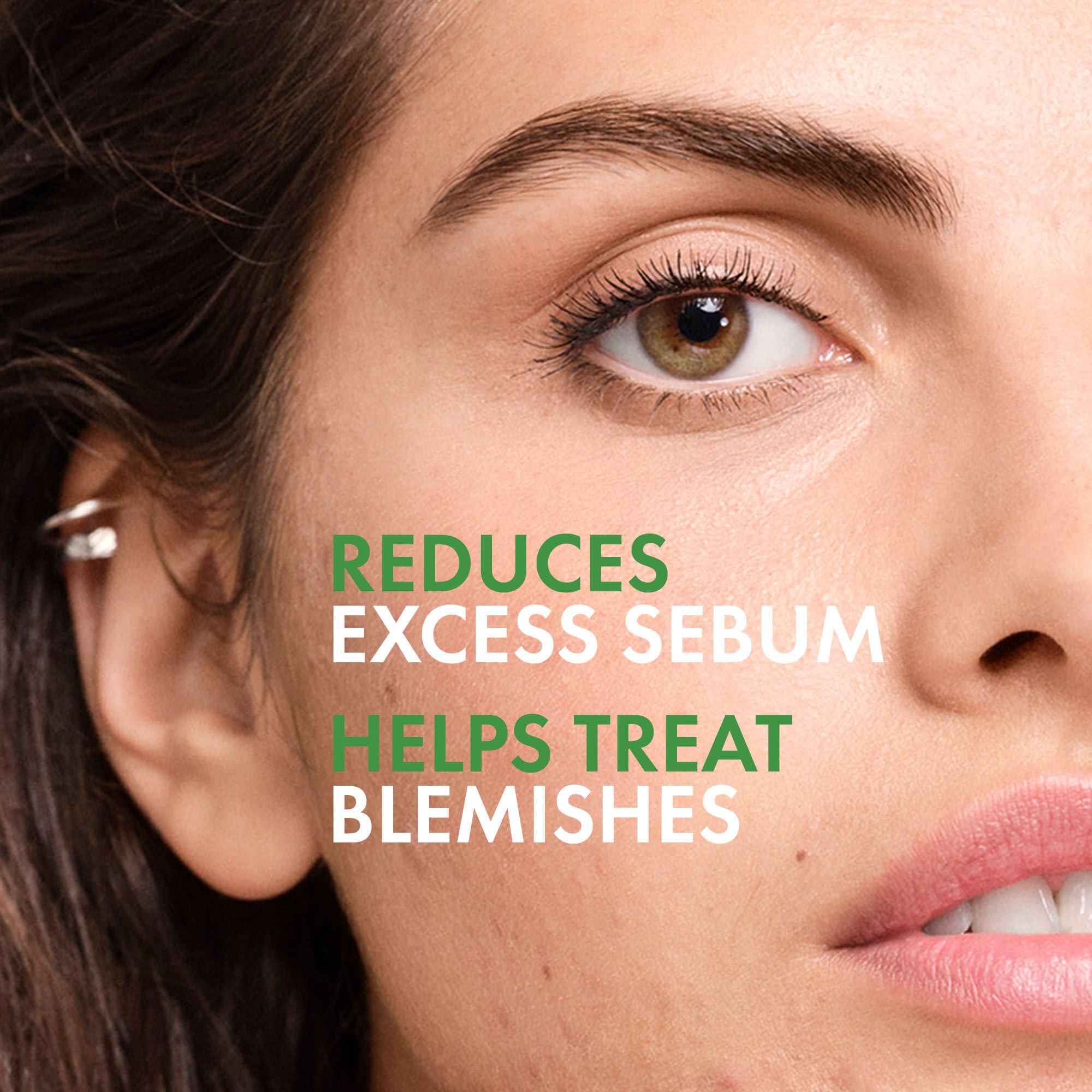 NORMADERM ANTI-ACNE PURIFYING GEL CLEANSER