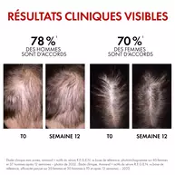 Dercos serum capillaire Regen Booster