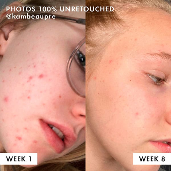 Skin is mattified